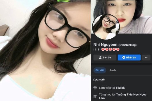 Nhi Nguyễn múp bướm không lông